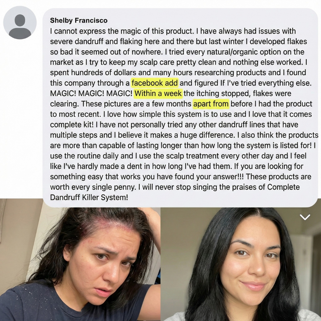 Complete Dandruff Killer System