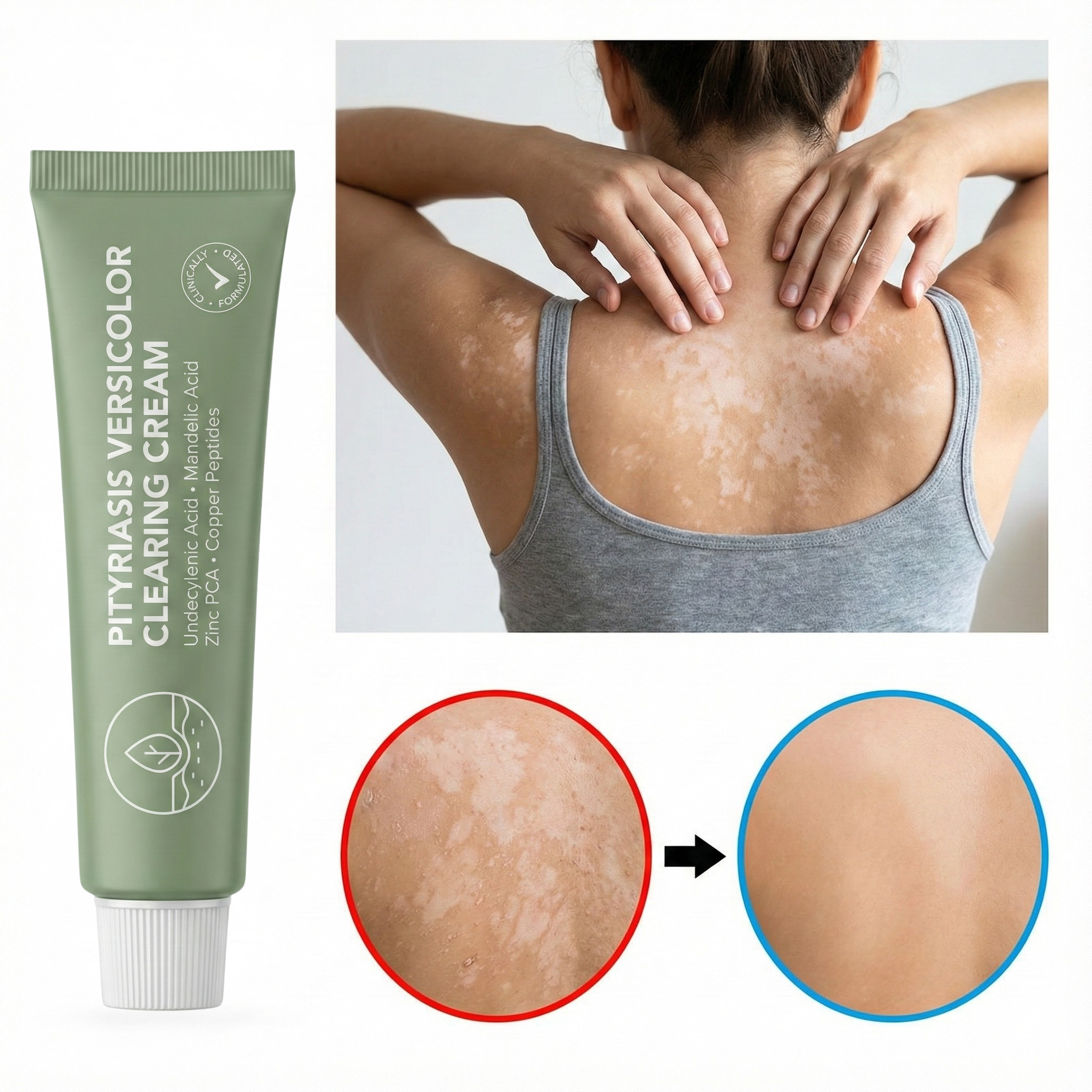 Healora Treatments – Healora™